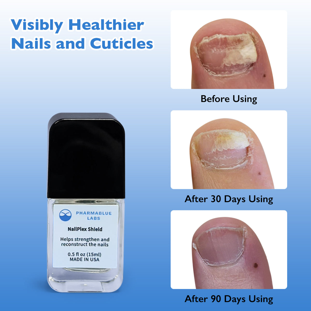 NailPlex Shield